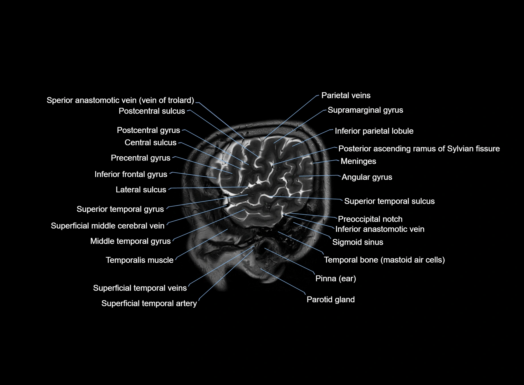brain sagittal anatomy 3T MRI images -img-00001-00009.webp